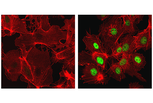 Immunofluorescence Image 1: HIF-1α (D1S7W) XP® Rabbit mAb (BSA and Azide Free)