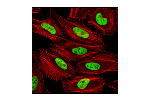  Image 34: Microglia Proliferation Module Antibody Sampler Kit
