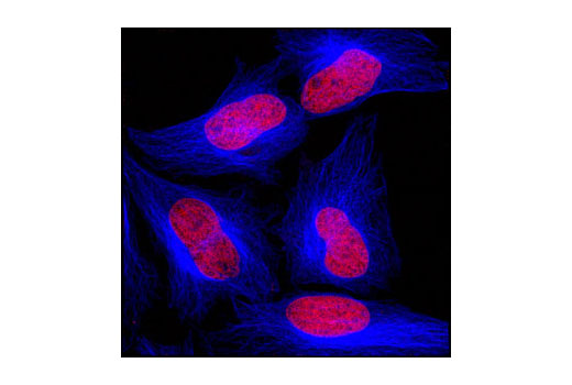 β-Tubulin (9F3) Rabbit MAb (Alexa Fluor® 647 Conjugate) | Cell ...