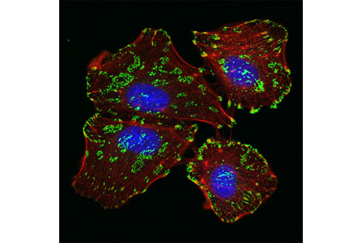 Immunofluorescence Image 1: Integrin β5 (D24A5) Rabbit mAb