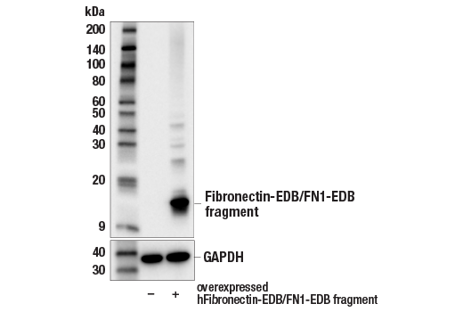 Western Blotting Image 2: Fibronectin-EDB/FN1-EDB (E8J3Z) Rabbit mAb