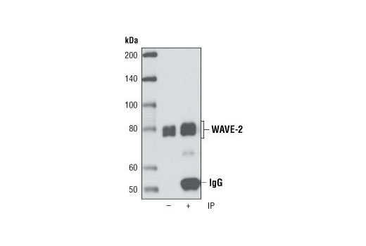  Image 9: Actin Nucleation and Polymerization Antibody Sampler Kit