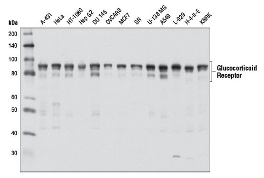  Image 24: Nuclear Receptor Antibody Sampler Kit