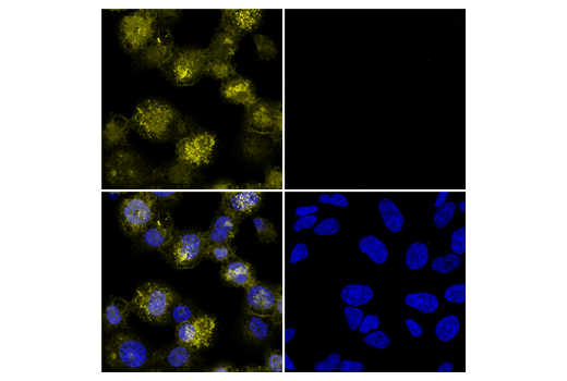 Immunofluorescence Image 3: Iba1/AIF-1 (E4O4W) XP® Rabbit mAb (Alexa Fluor® 555 Conjugate)