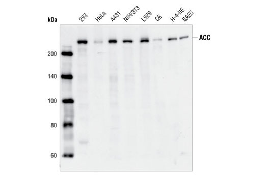 Western Blotting Image 1: Acetyl-CoA Carboxylase Antibody
