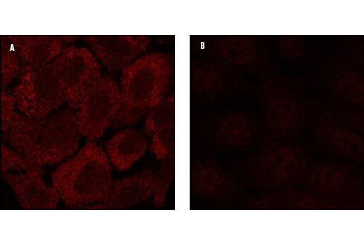 Immunofluorescence Image 1: Acetyl-CoA Carboxylase Antibody