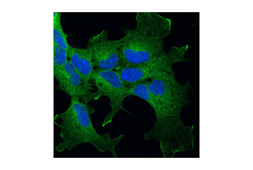 Immunofluorescence Image 1: p115 RhoGEF (D25D2) XP® Rabbit mAb