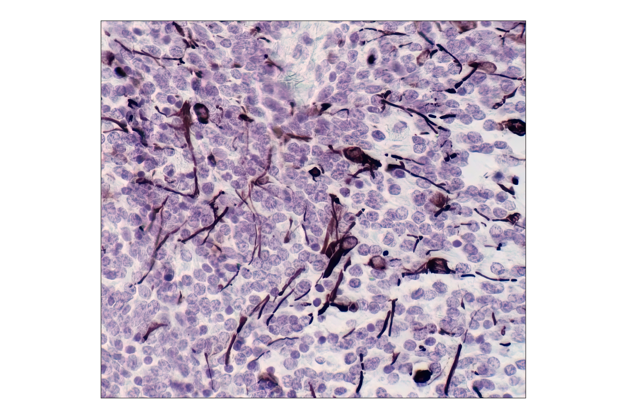  Image 6: Neuronal Marker IF Antibody Sampler Kit II