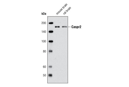 Western Blotting Image 1: Caspr2 Antibody