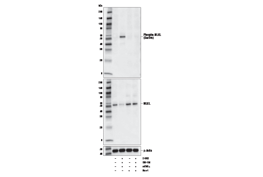  Image 3: Mouse Reactive Cell Death and Autophagy Antibody Sampler Kit