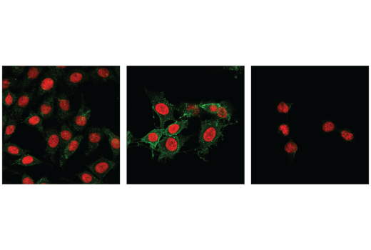  Image 16: Mouse Reactive Cell Death and Autophagy Antibody Sampler Kit