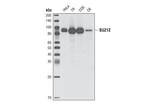  Image 4: Polycomb Group 2 (PRC2) Antibody Sampler Kit