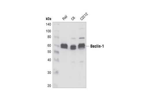 Western Blotting Image 1: Beclin-1 Antibody