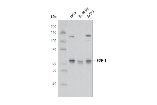 Western Blotting Image 1: E2F-1 Antibody