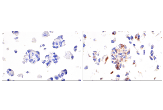 Immunohistochemistry Image 1: CXCL9/MIG (E6Z5W) Rabbit mAb (BSA and Azide Free)