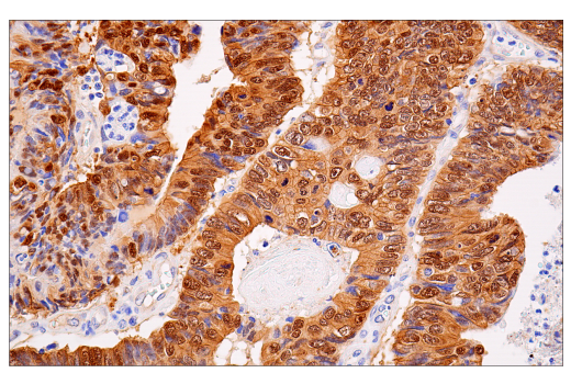 Immunohistochemistry Image 2: β-Catenin (15B8) Mouse mAb