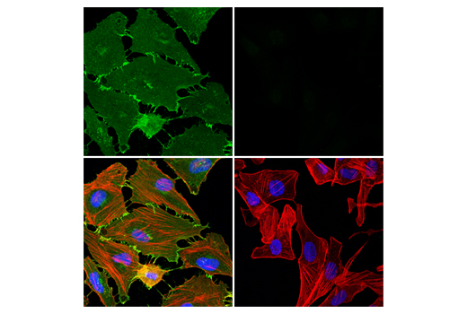 Immunofluorescence Image 1: β-Catenin (15B8) Mouse mAb