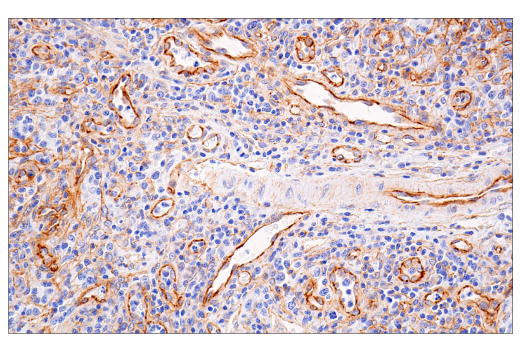 Immunohistochemistry Image 6: β-Catenin (15B8) Mouse mAb