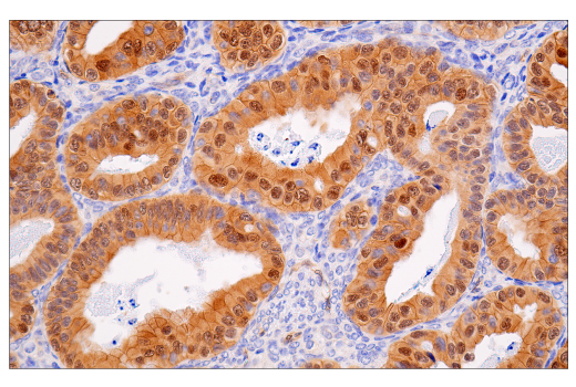 Immunohistochemistry Image 8: β-Catenin (15B8) Mouse mAb