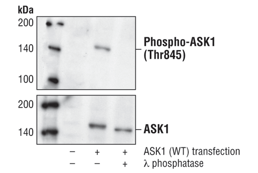 Western Blotting Image 1: Phospho-ASK1 (Thr845) Antibody