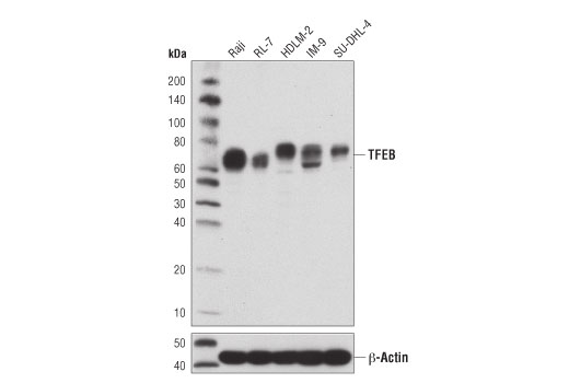 Image 6: TFEB Signaling Antibody Sampler Kit