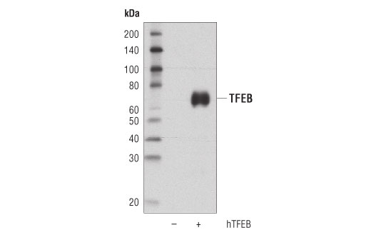  Image 11: TFEB Signaling Antibody Sampler Kit