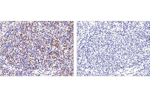 Immunohistochemistry Image 2: TFEB (D2O7D) Rabbit mAb