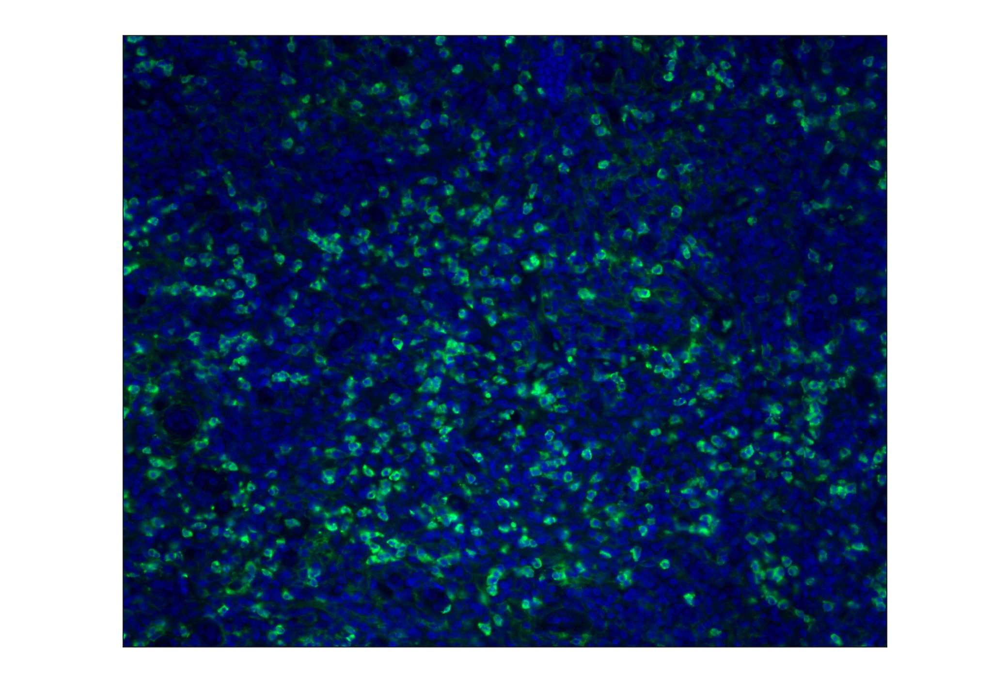 Immunohistochemistry Image 1: CD11b/ITGAM (D6X1N) Rabbit mAb (Alexa Fluor® 488 Conjugate)