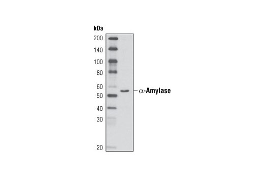Western Blotting Image 1: α-Amylase (D55H10) XP® Rabbit mAb