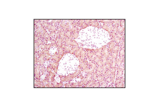 Immunohistochemistry Image 2: α-Amylase (D55H10) XP® Rabbit mAb