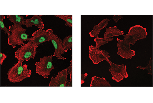 Immunofluorescence Image 2: Mouse (E1D5H) mAb IgG3 Isotype Control