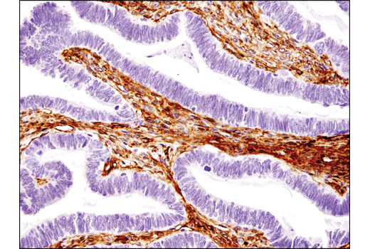Immunohistochemistry Image 3: CD105/Endoglin (3A9) Mouse mAb (BSA and Azide Free)