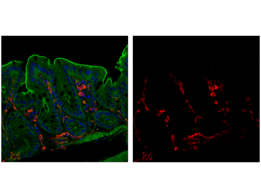 Immunofluorescence Image 1: VISTA (D5L5T) XP® Rabbit mAb (Alexa Fluor® 647 Conjugate)