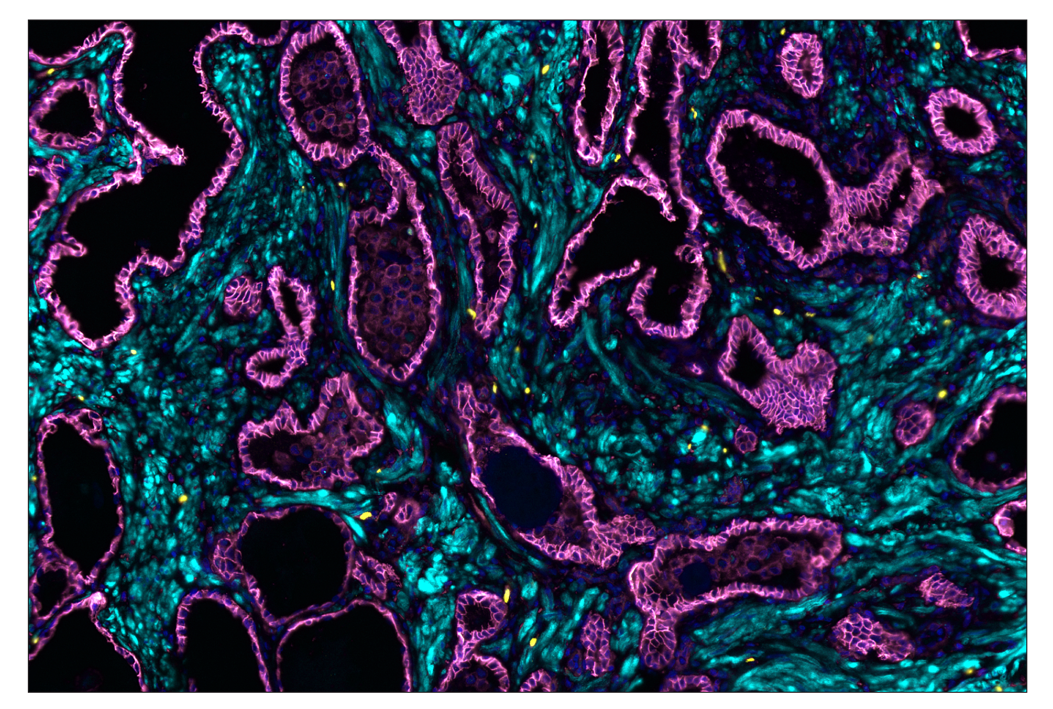 Immunohistochemistry Image 1: Sox10 (E6B6I) & CO-0080-647 SignalStar™ Oligo-Antibody Pair