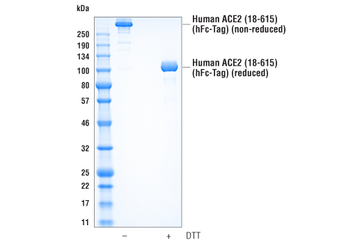  Image 1: Human ACE2 (18-615) Recombinant Protein (hFc-Tag)