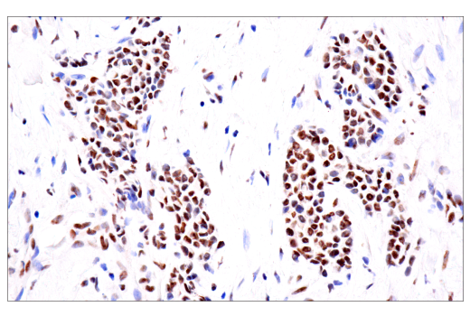 Immunohistochemistry Image 1: TDP43 (E2G6G) Rabbit mAb (BSA and Azide Free)