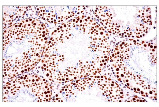 Immunohistochemistry Image 6: TDP43 (E2G6G) Rabbit mAb (BSA and Azide Free)