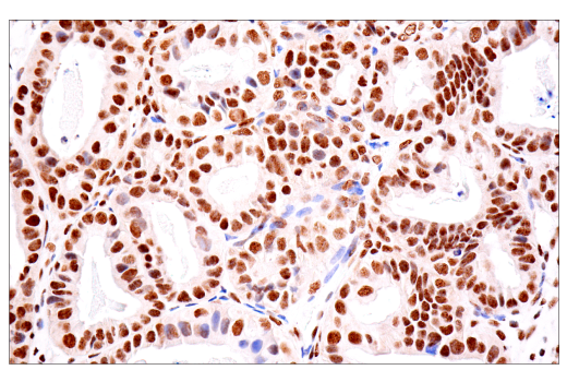 Immunohistochemistry Image 8: TDP43 (E2G6G) Rabbit mAb (BSA and Azide Free)