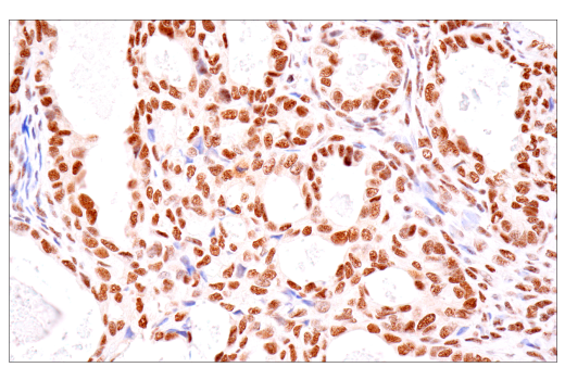Immunohistochemistry Image 9: TDP43 (E2G6G) Rabbit mAb (BSA and Azide Free)