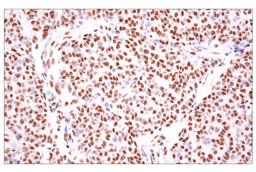 Immunohistochemistry Image 10: TDP43 (E2G6G) Rabbit mAb (BSA and Azide Free)