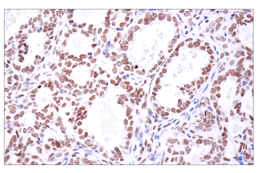  Image 54: BAF Complex IHC Antibody Sampler Kit