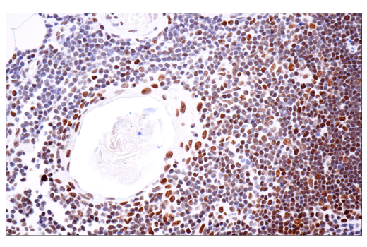  Image 72: BAF Complex IHC Antibody Sampler Kit