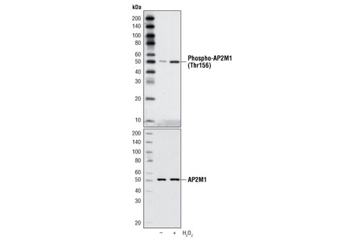 Western Blotting Image 1: Phospho-AP2M1 (Thr156) Antibody