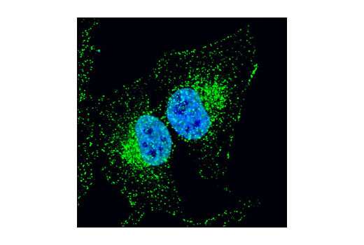 Immunofluorescence Image 1: APPL1 (D83H4) XP® Rabbit mAb
