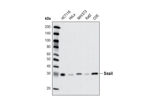  Image 14: Epithelial-Mesenchymal Transition (EMT) Antibody Sampler Kit