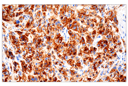 Immunohistochemistry Image 1: PMEL/Melanoma gp100 (HMB45) Mouse mAb