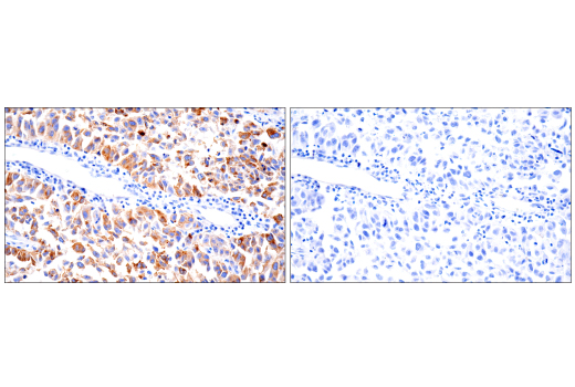 Immunohistochemistry Image 4: PMEL/Melanoma gp100 (HMB45) Mouse mAb