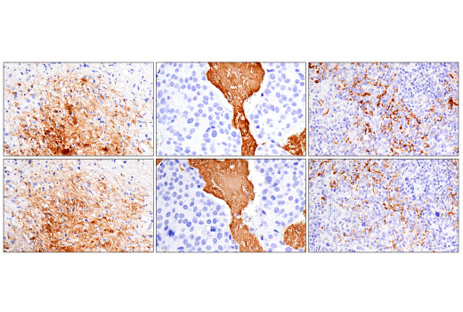 Immunohistochemistry Image 7: Fibrinogen gamma chain (E1U3Z) XP® Rabbit mAb (BSA and Azide Free)