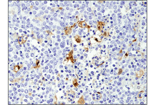 Immunohistochemistry Image 1: ARC (D7Q3G) Rabbit mAb