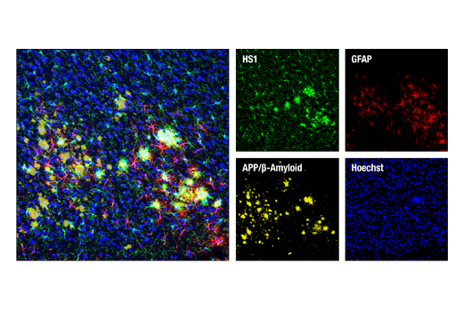  Image 33: Tau Mouse Model Neuronal Viability IF Antibody Sampler Kit
